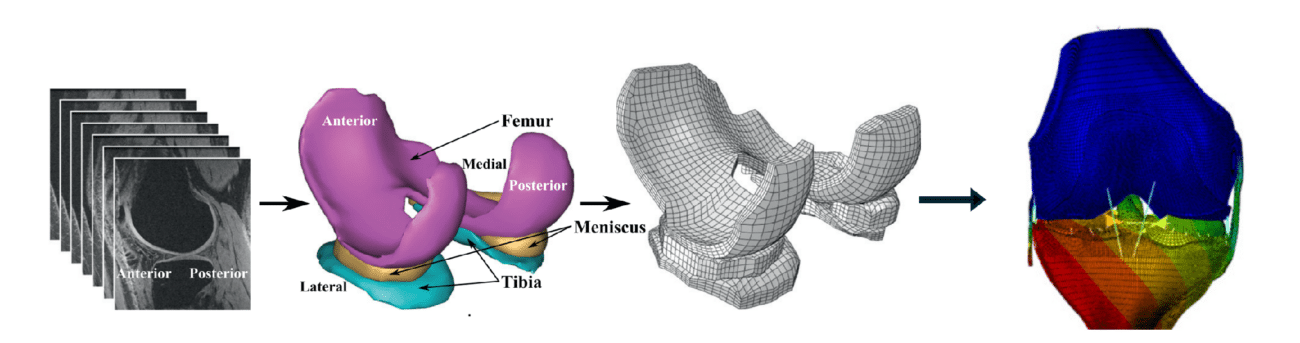 MRI, Segmentation and Meshing
